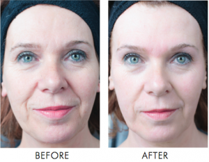 SPECIAL OFFER FOR YOU!Anti ageing beauty treatment service before was 90£, now it is just 65£